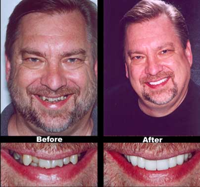 Smile Makeovers at Dumont Dentist