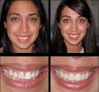 Rejuevenate your smile at Dumont Dentist